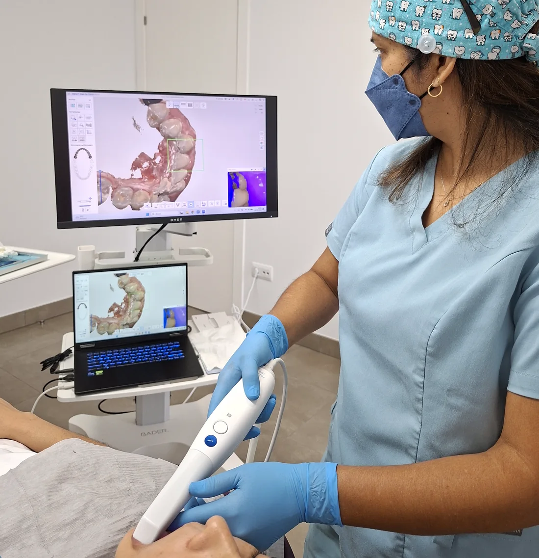 Escàner intraoral en ús a Nova Dental Vidreres